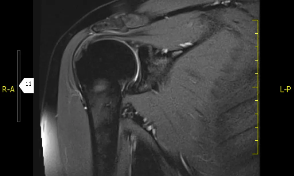 Resonancia magnética 1 región anatómica
