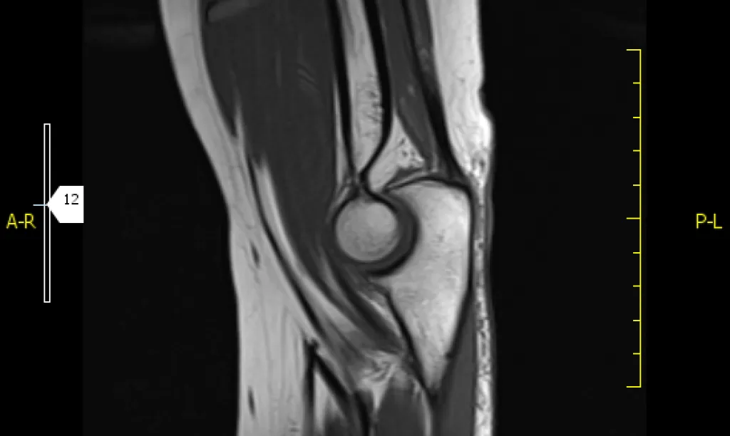 Resonancia magnética 2 regiones anatómicas